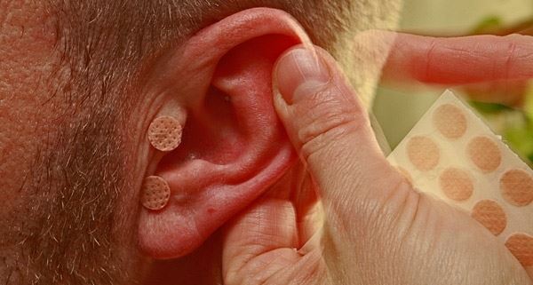 Allergibehandling med akupunktur i Hjørring nær Frederikshavn og Hirtshals